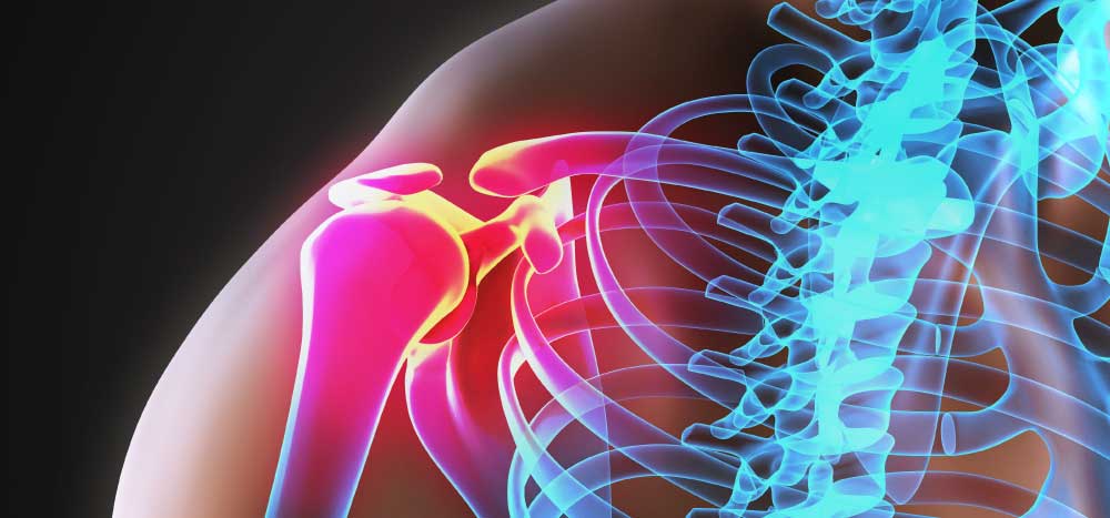 Shoulder Pain Boise | Shoulder Pain Specialists & Treatment Boise